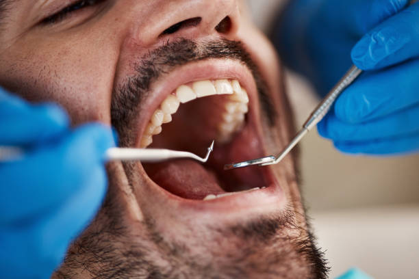 Best Tooth Pain Emergency Relief  in Durand, IL