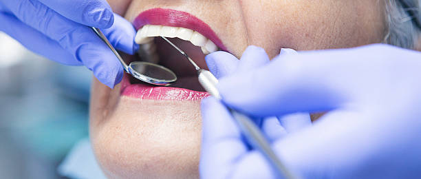 Best Urgent Tooth Repair  in Durand, IL